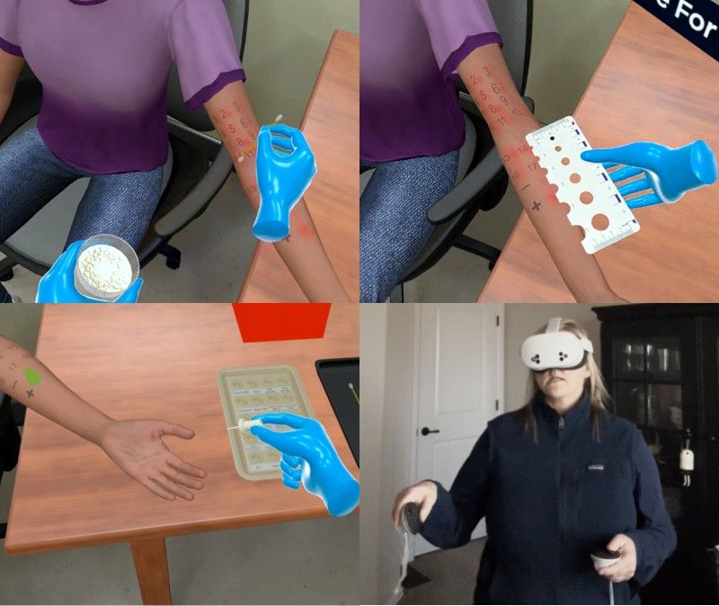 Clinical Medical Assistant performing Skin Prick Testing